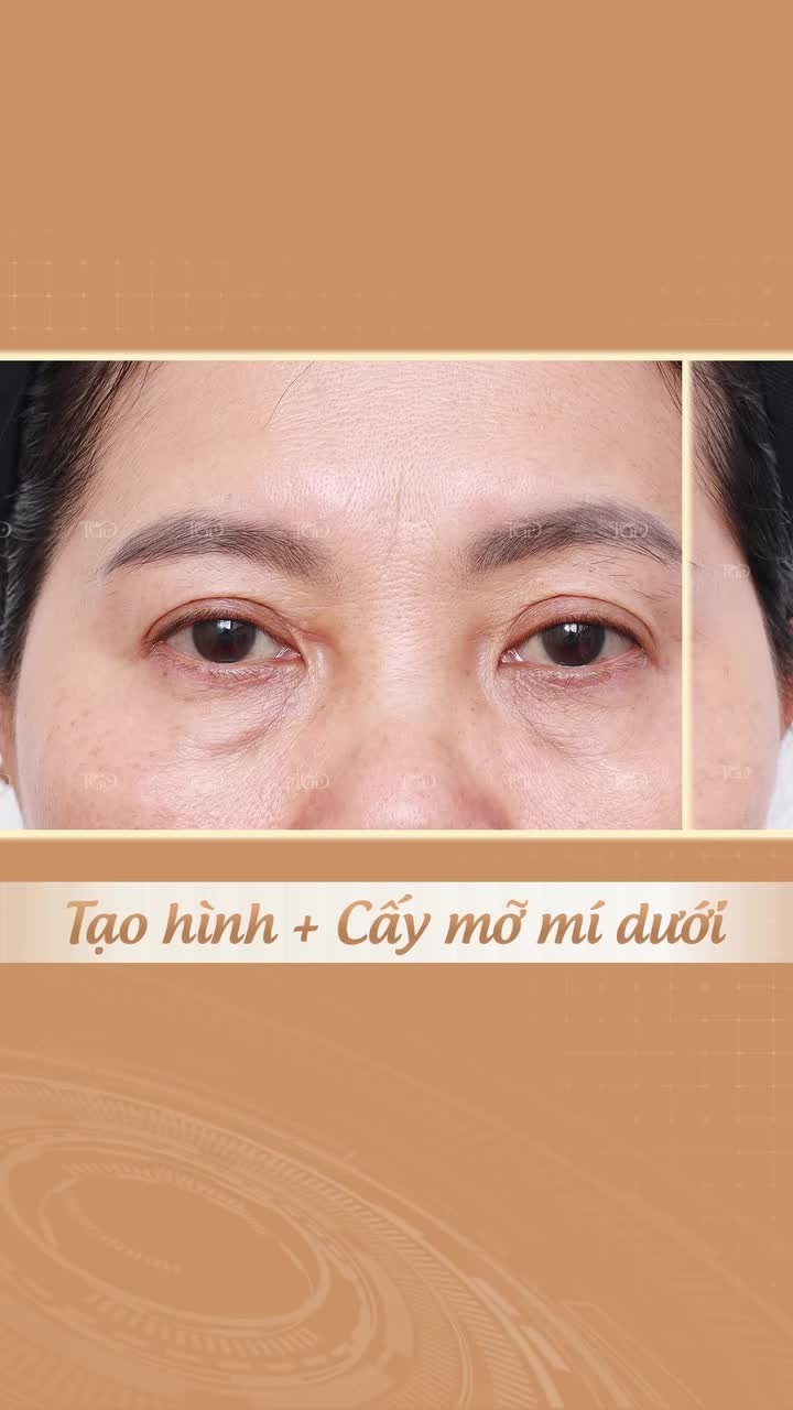 U60 nhưng nhìn lúc nào cũng mệt mỏi chỉ vì một vị trí đã “tố cáo” tất cả.