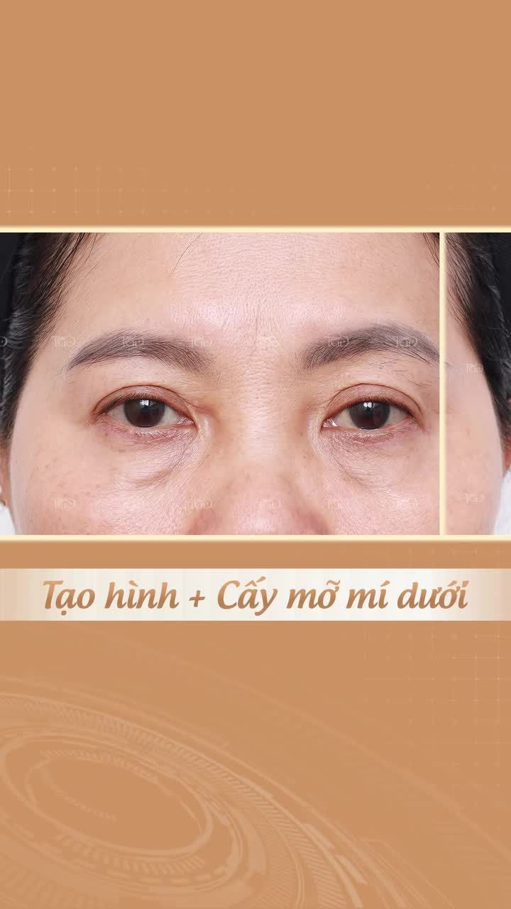 U60 nhưng nhìn lúc nào cũng mệt mỏi chỉ vì một vị trí đã “tố cáo” tất cả.