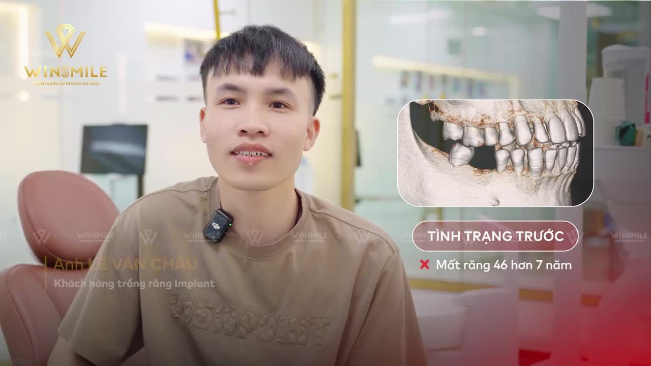 Nhiều năm làm việc tại Nhật Bản cũng là quãng thời gian anh Lê Văn Châu chưa có điều kiện để điều trị chiếc răng đã mất của mình.