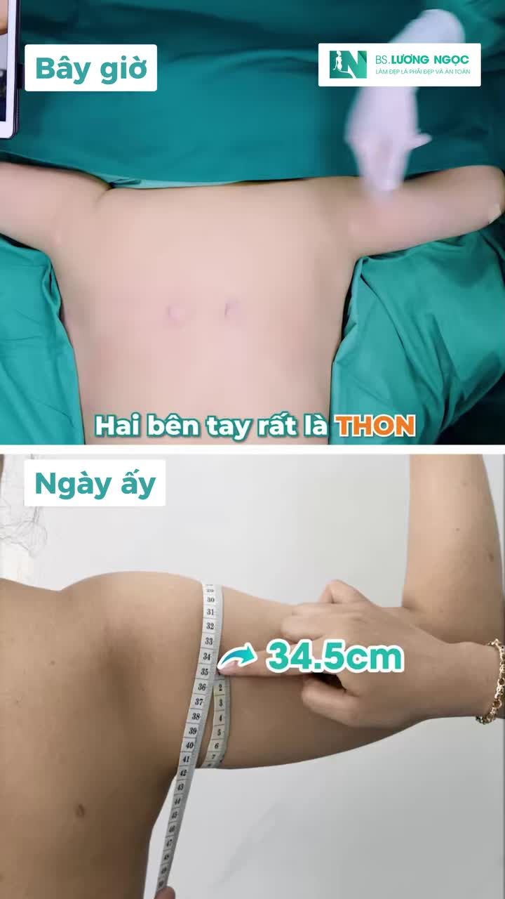 Chỉ sau 90 phút cải thiện vùng mỡ "trơ lì", kết quả sẽ thay đổi như thế nào