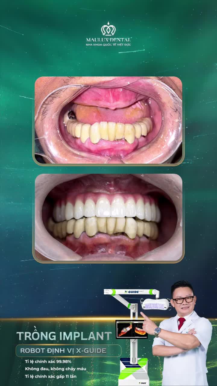 NỤ CƯỜI HẠNH PHÚC MỚI