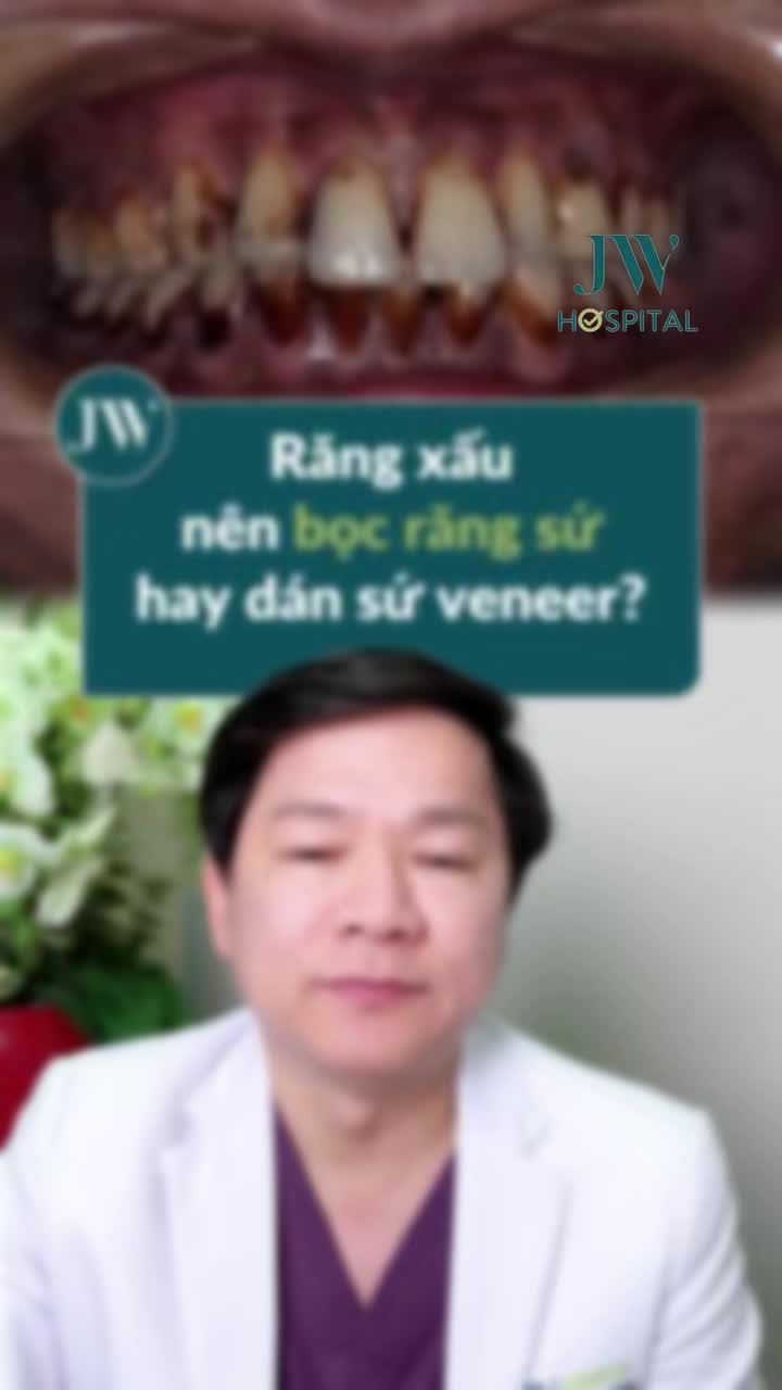 BÁC SĨ TÚ DUNG GIẢI MÃ RĂNG MẺ, Ố VÀNG NÊN BỌC SỨ HAY DÁN SỨ ĐỂ RĂNG TRẮNG SÁNG ĐẲNG CẤP