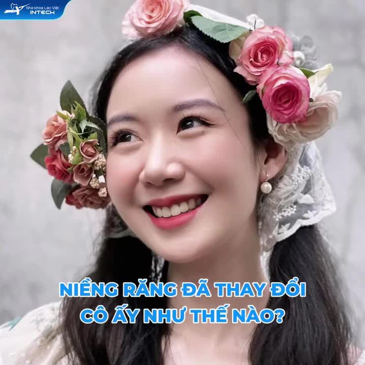 NGƯỜI NGOÀI TIẾC CHO “RĂNG KHỂNH DUYÊN”, CÒN BẢN THÂN THÌ MỖI NGÀY SỐNG TRONG SỰ TỰ TI