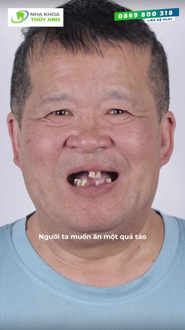 "NGƯỜI KHÁC ĂN MỘT QUẢ TÁO MẤT 2 PHÚT, CÒN TÔI PHẢI MẤT ĐẾN 30 PHÚT…”