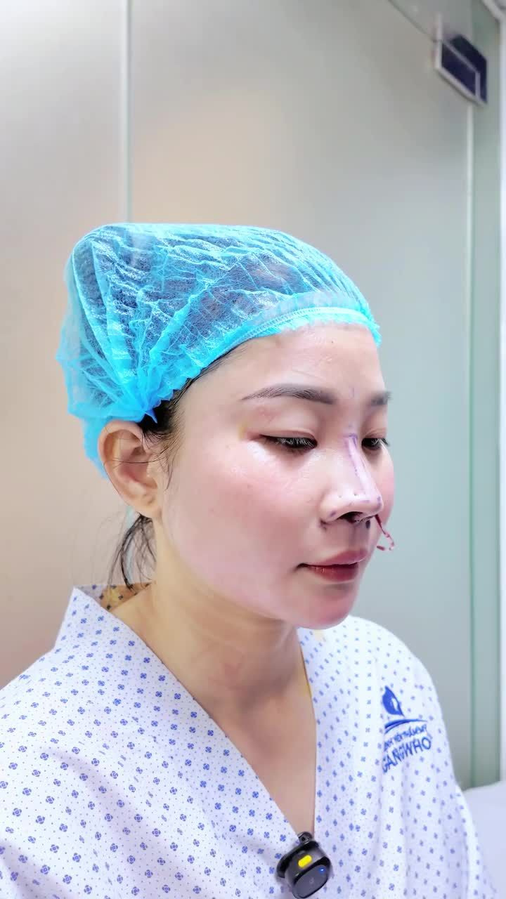 KHÁCH HÀNG CHIA SẺ THẬT: NÂNG MŨI CÓ ĐAU KHÔNG? NGHE CÂU TRẢ LỜI NGAY TẠI PHÒNG HẬU PHẪU!