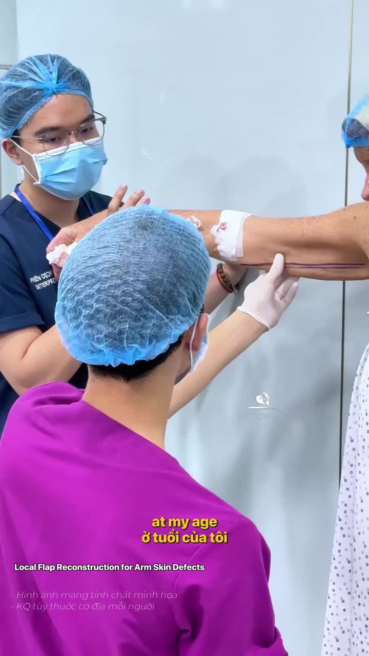 Loại bỏ da dư, da chùng ở cánh tay giúp cô ấy cảm thấy tự tin hơn