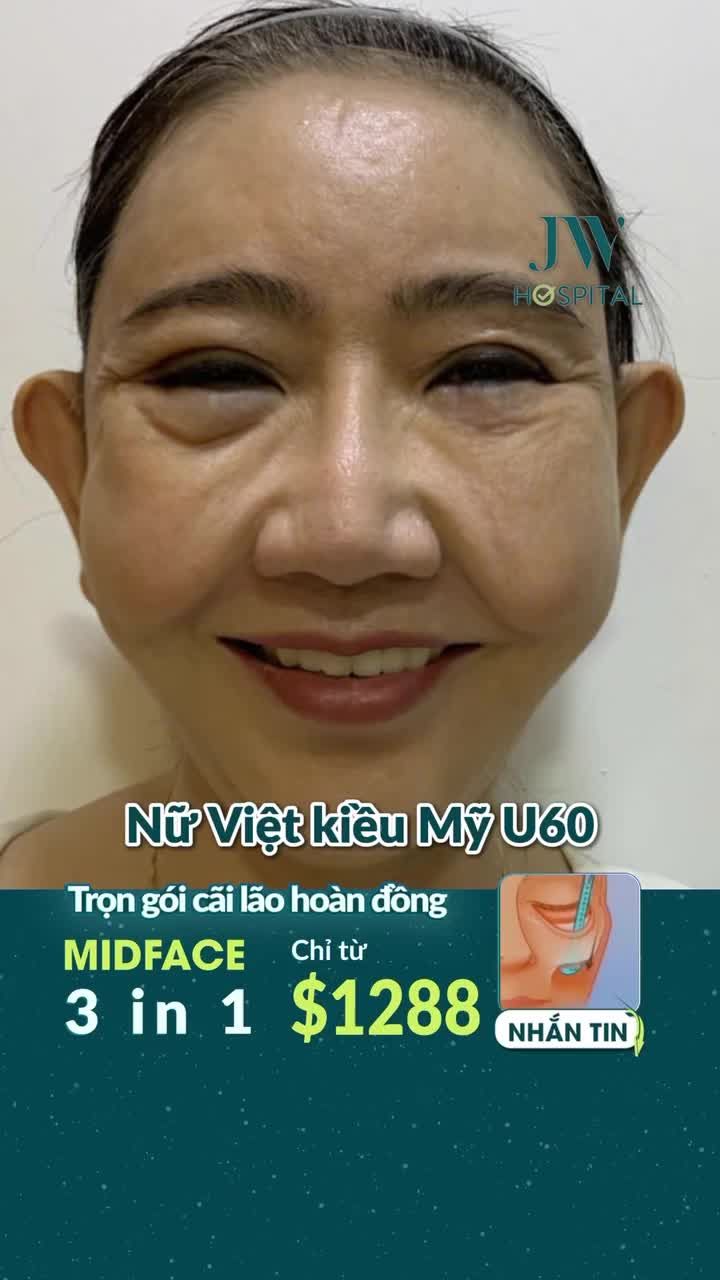 TIẾT KIỆM GẤP 10 LẦN Ở MỸ - COMBO TRẺ HÓA MẮT CHO VIỆT KIỀU U70  XOÁ NHĂN MẮT, RÃNH CƯỜI - CẢI LÃO 20 TUỔI