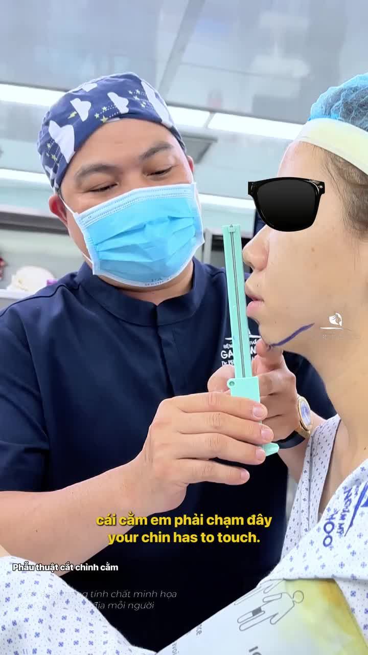 Phương pháp trượt cằm, ứng dụng công nghệ nội soi 4K hiện đại. Quá trình phẫu thuật nhẹ nhàng và hồi phục nhanh chóng. Cùng đón chờ diện mạo từ bạn trong những phần tiếp theo nhé