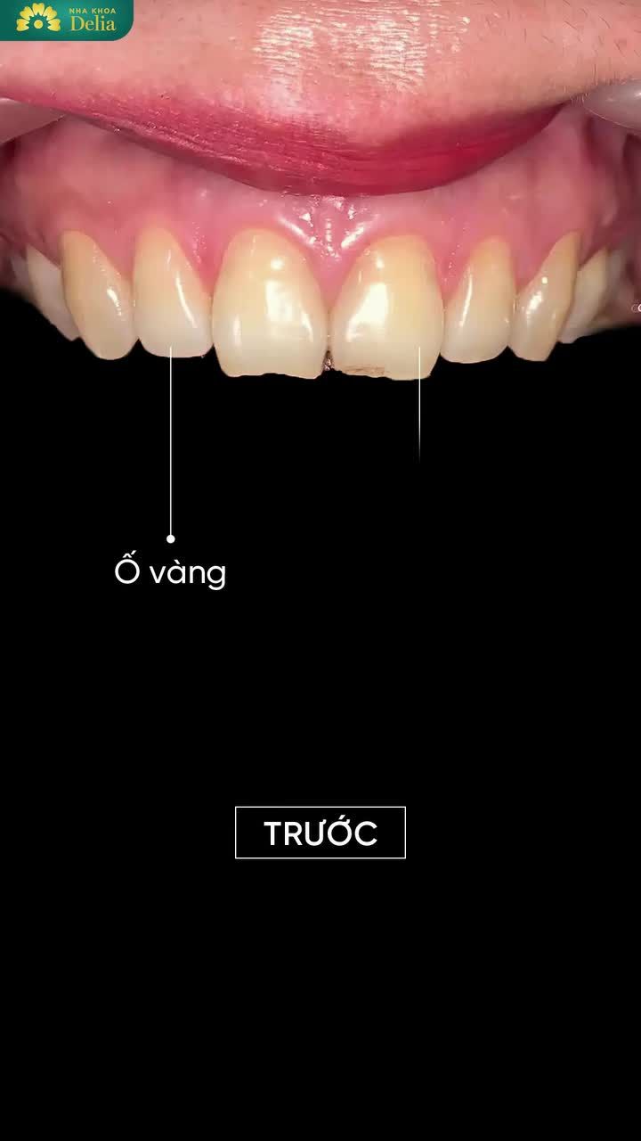 KIẾN TẠO NỤ CƯỜI TỰ TIN CHO NỮ DOANH NHÂN 9X