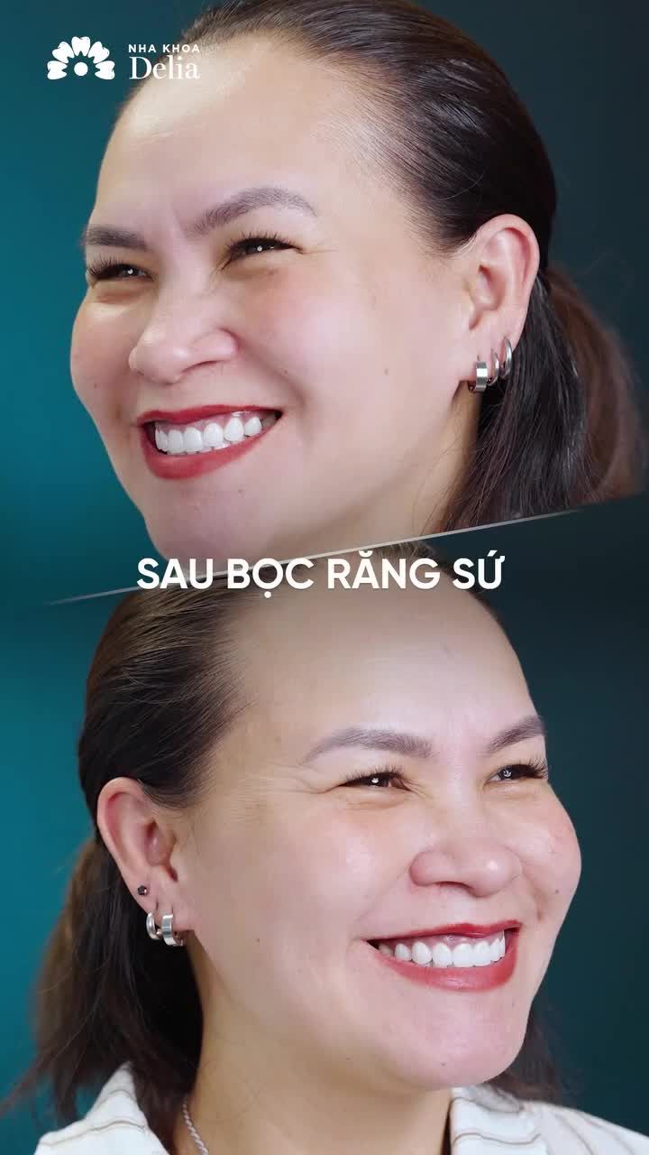 TỪ NGÀY LÀM RĂNG SỨ VỀ CHỊ THÍCH NGẮM NỤ CƯỜI CỦA MÌNH MỖI NGÀY