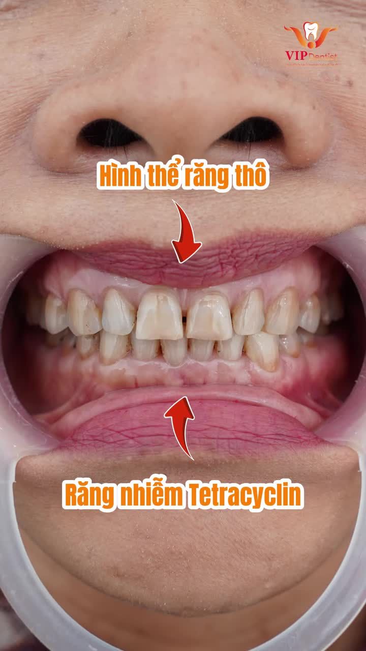 CÒN CƠ HỘI TẠI SAO KHÔNG THAY ĐỔI!