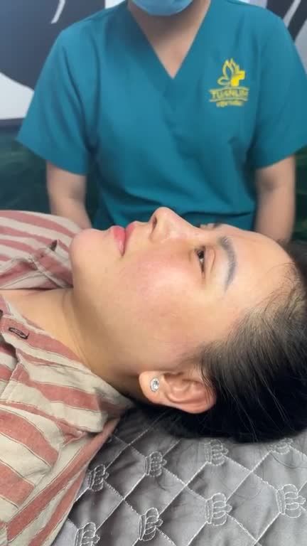 MŨI CẤU TRÚC RÚT CHỈ SURGIFORM SAU 10 NGÀY ĐẸP XUẤT SẮC!!