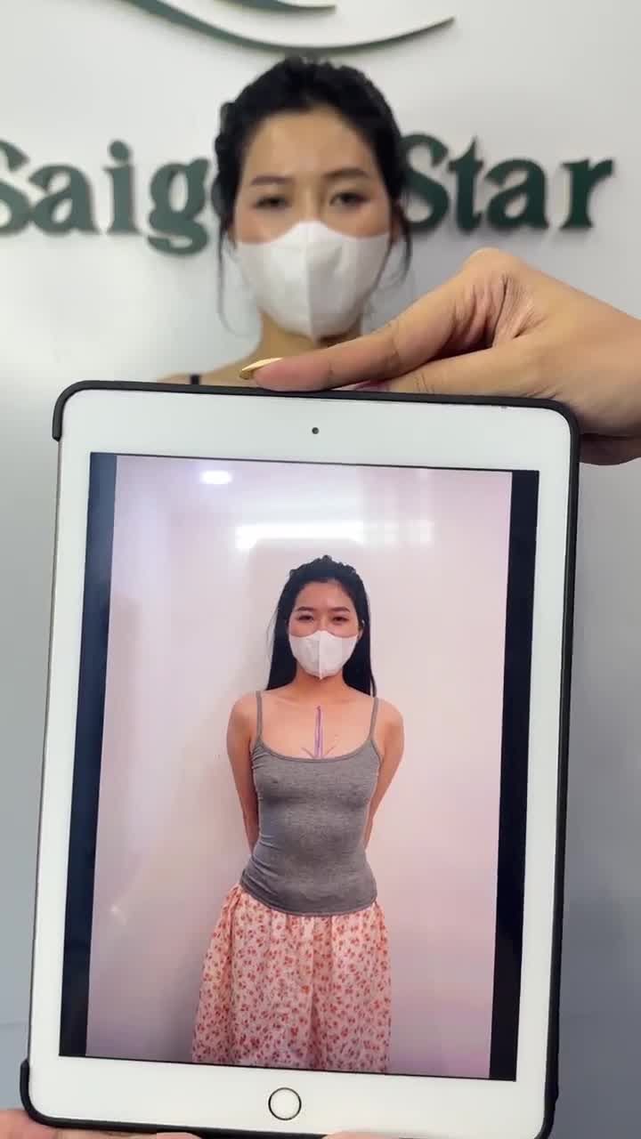 14 ngày NÂNG VÒNG 1 KHÔNG CHẠM DR. HOẠT
