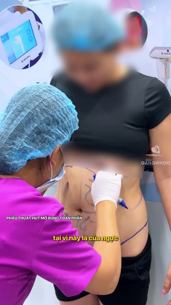 Làm đẹp thông minh cùng mẹ bỉm, bí quyết để có dáng đẹp nhưng vẫn an tâm tài chính!!!