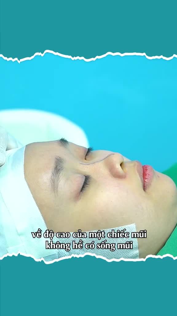 Phân vân giữa nâng mũi cấu trúc và nâng mũi sụ.n sườn thì nhất định nên xem clip này của bác sĩ trước nha