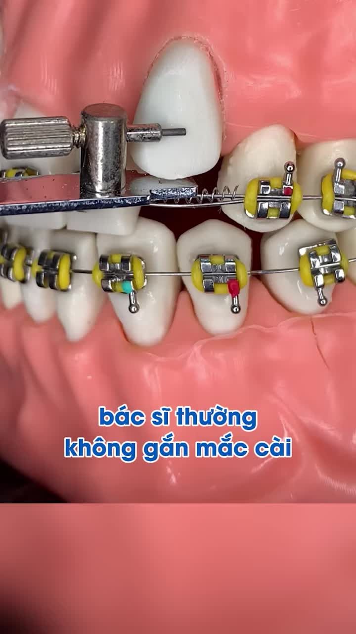 Thứ tự ưu tiên này sẽ giúp quá trình trôi chảy và dễ chịu hơn.