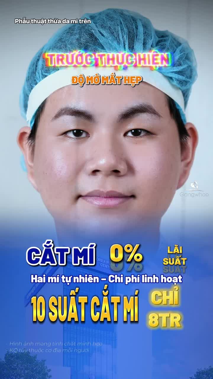 Bạn nào còn ngại thẩm mỹ, lo kết quả thiếu tự nhiên thì xem ngay sự thay đổi của khách hàng tại Gangwhoo.