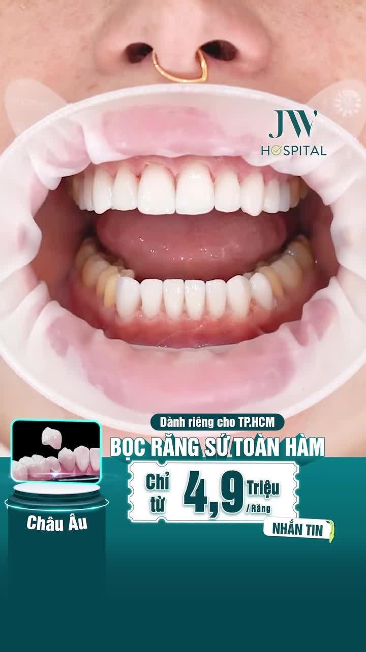 ƯU TIÊN TPHCM: BỌC RĂNG SỨ GIÁ TỐT NHẤT NĂM TỪ 4.9 TRIỆU