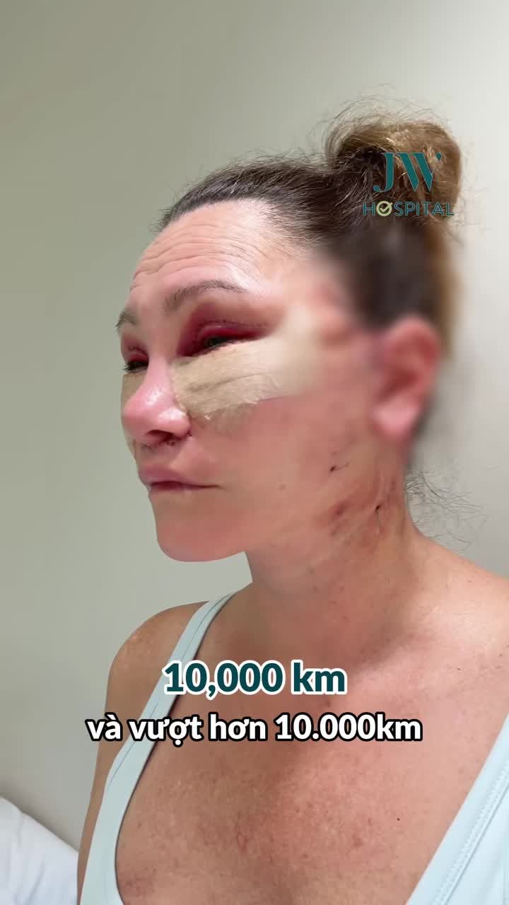 NGƯỜI PHỤ NỮ U70 TỪ CHỐI THẨM MỸ TẠI ÚC ĐỂ BAY ĐẾN JW CẢI LÃO 20 TUỔI - TIẾT KIỆM GẤP 5 LẦN