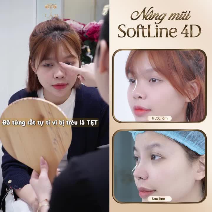 Từ chiếc mũi thấp, cánh mũi to bè...