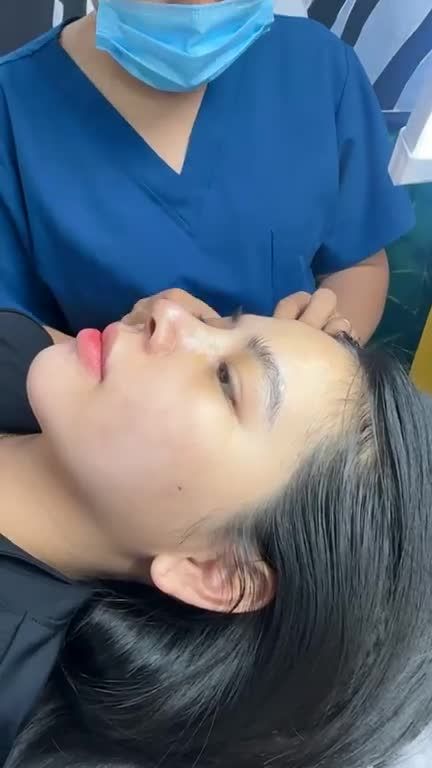 MŨI CẤU TRÚC SAU 10 NGÀY ĐẸP XUẤT SẮC!!