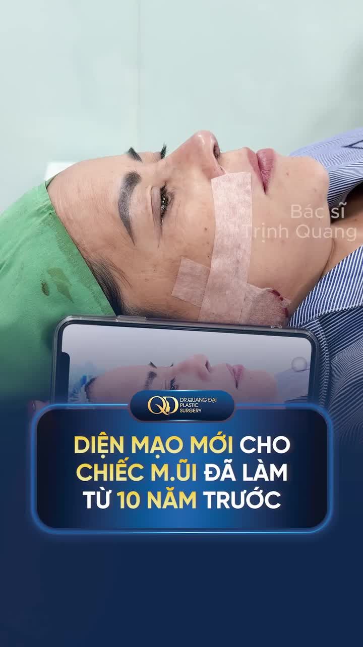 DIỆN MẠO MỚI CHO CHIẾC MŨI ĐÃ LÀM TỪ 10 NĂM TRƯỚC