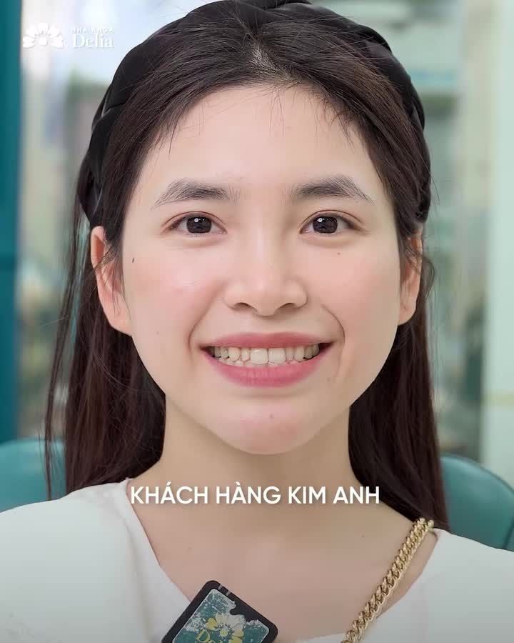 Xem thêm 1185 video Bọc Răng Sứ của bác sĩ Bs nha khoa Delia