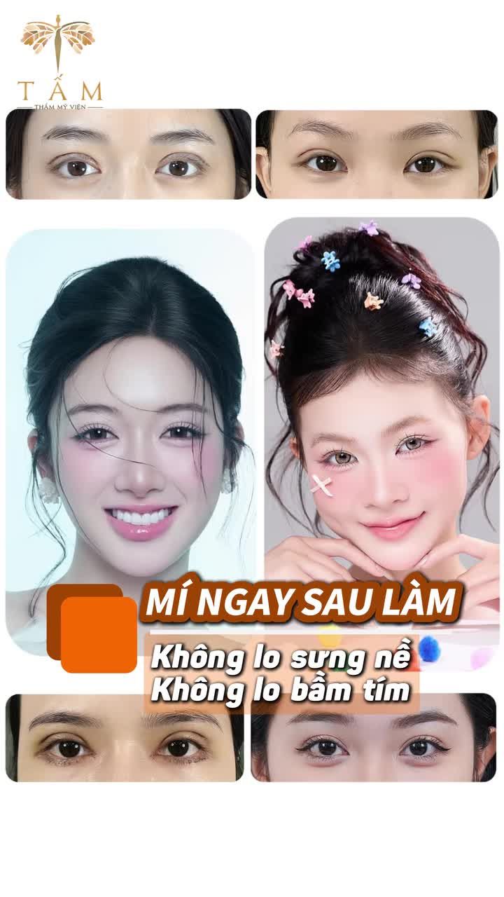 Mí ổn định nhanh, vào form tự nhiên chỉ sau 7 ngày