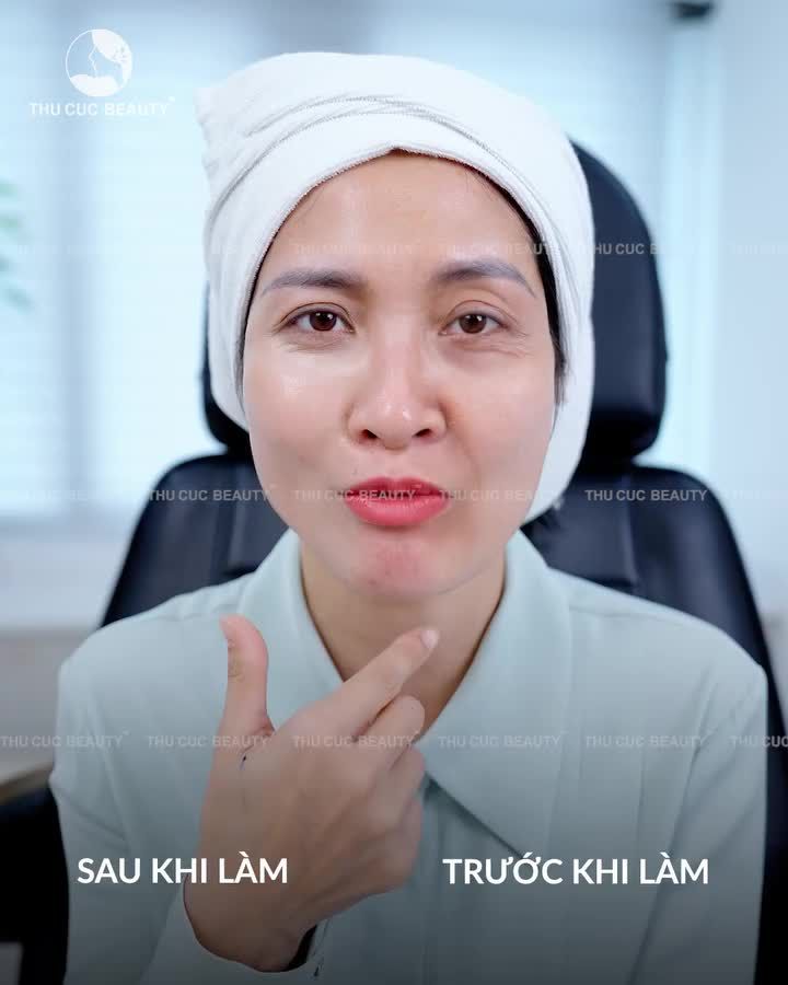 Kiểm chứng lời đồn: HIFU Q+ TẠI THU CÚC GIÚP TRẺ HÓA TỨC THÌ?
