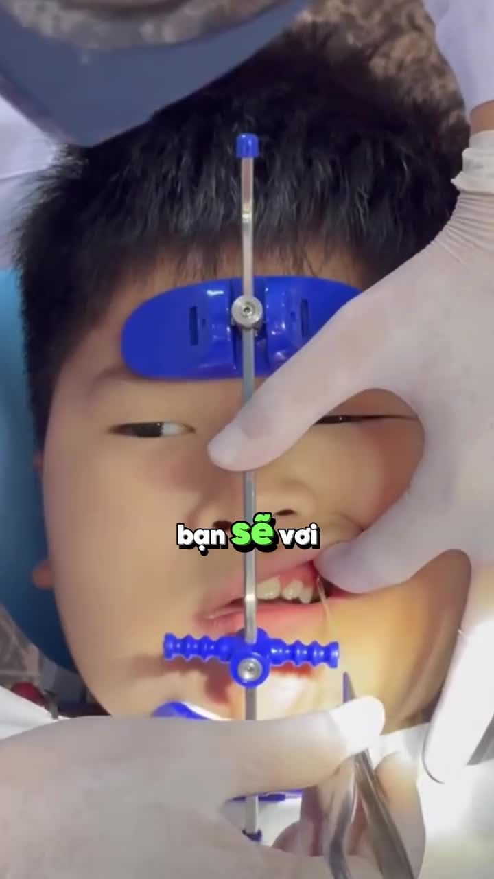CHECK GIÁ CÁC LOẠI KHÍ CỤ NIỀNG RĂNG HIỆN NAY