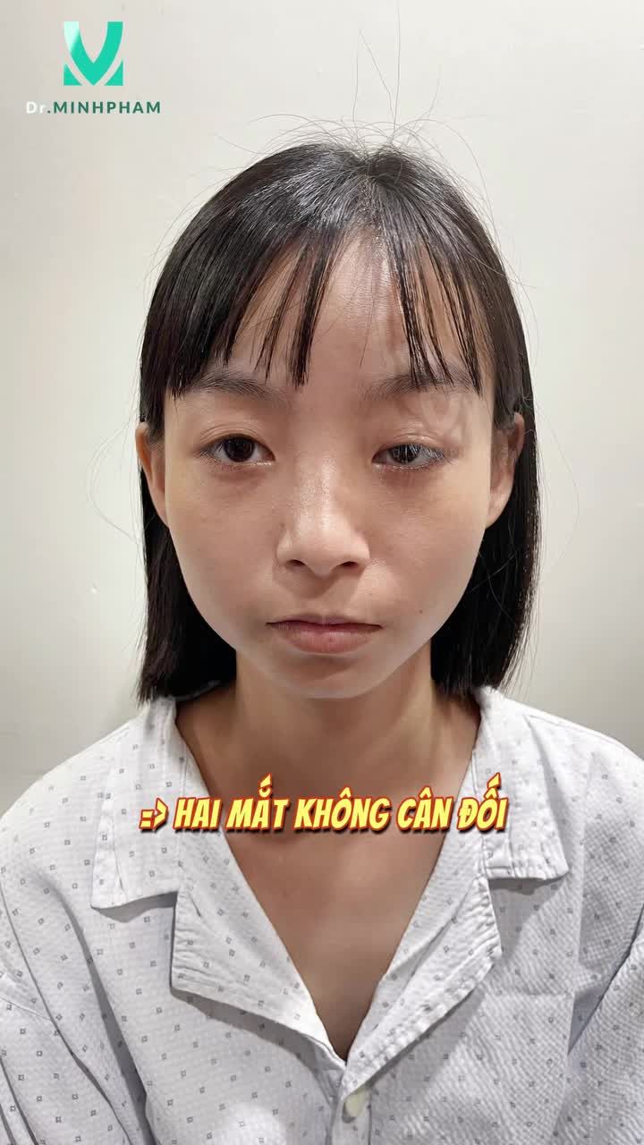 Khách hàng trước khi đến với Dr. Minh Phạm có tình trạng