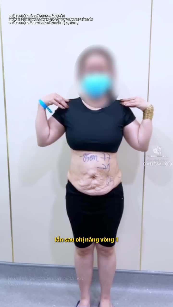 Trải qua 3 lần làm đẹp tại Gangwhoo, chị khách chia sẻ hài lòng sau cả 3 lần