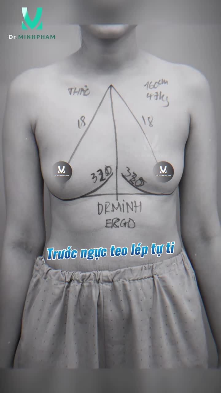 Vòng 1 siêu đẹp với dòngMotiva 335cc