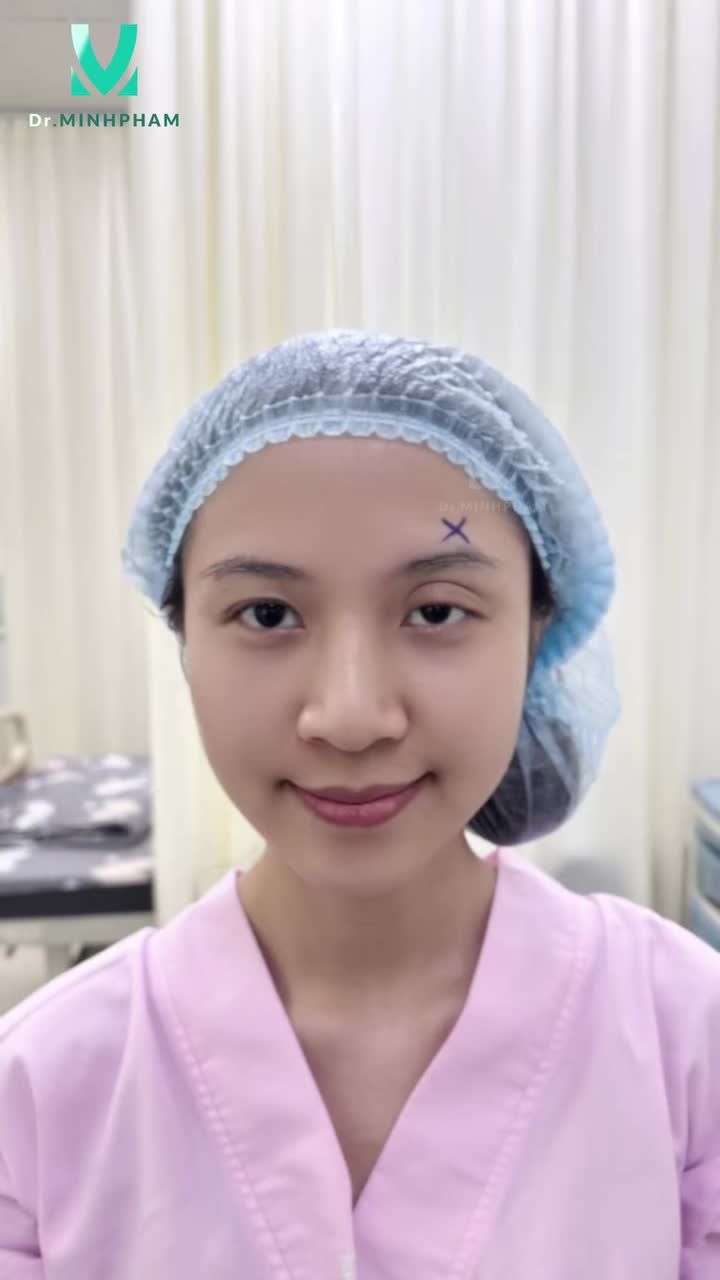 6 THÁNG THU CƠ NÂNG MI – ÁNH NHÌN RẠNG RỠ HƠN MỖI NGÀY