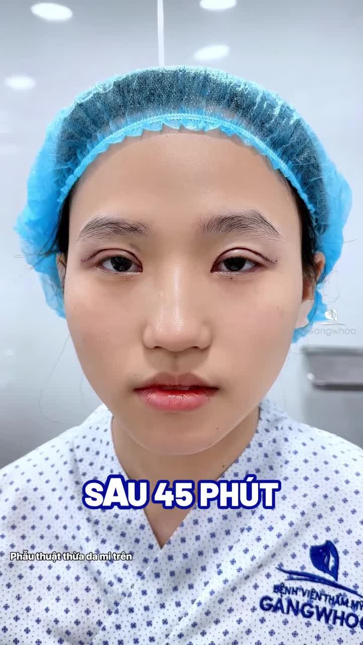Từ đôi mắt buồn ngủ, thiếu sức sống đến ánh nhìn cuốn hút không thể rời mắt. Visual bạch nguyệt quang đúng là có thật.