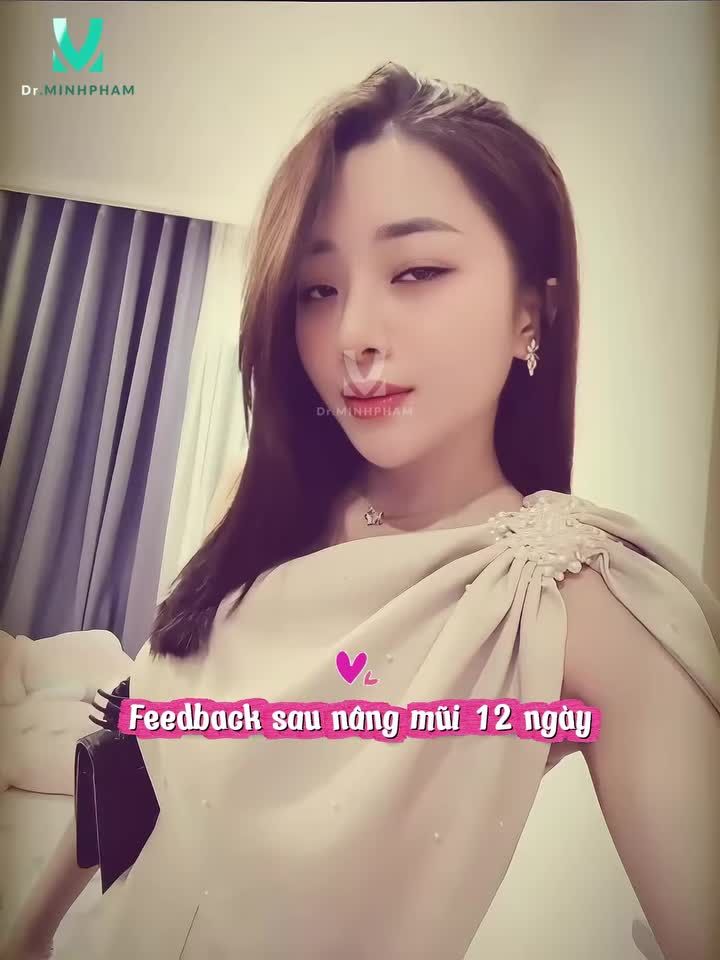 Chỉ cần thay đổi dáng mũi là tổng thể gương mặt có thể “lên hạng” rõ rệt
