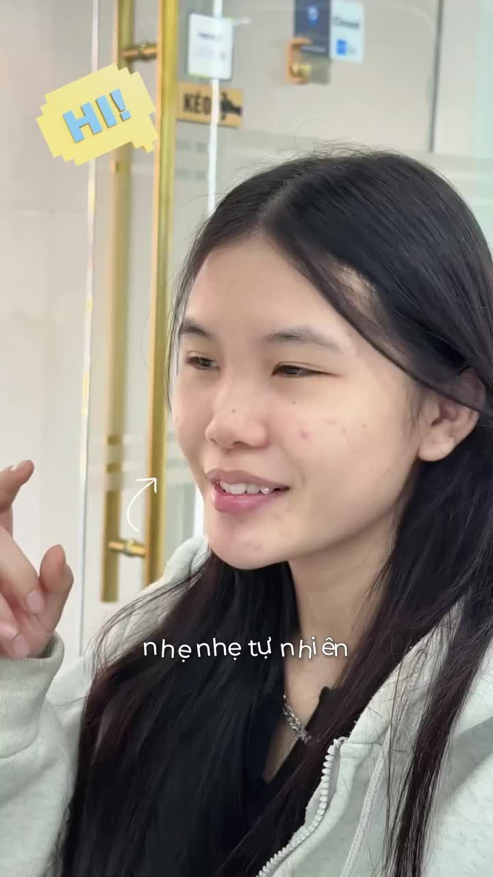 Bé khách đã từng chọn tiêm filler với mong muốn lên dáng mũi cao tự nhiên.