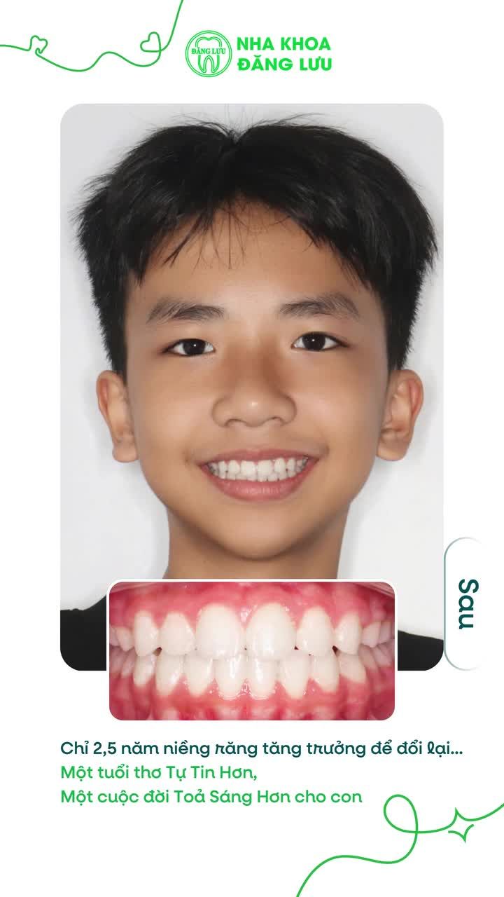 Đầu tư sự tự tin cho con ngay từ việc thay đổi Nụ Cười