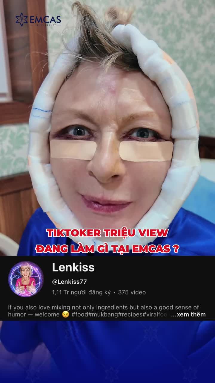 Tiktoker triệu view Lenkiss đã thay đổi như thế nào khi đến EMCAS