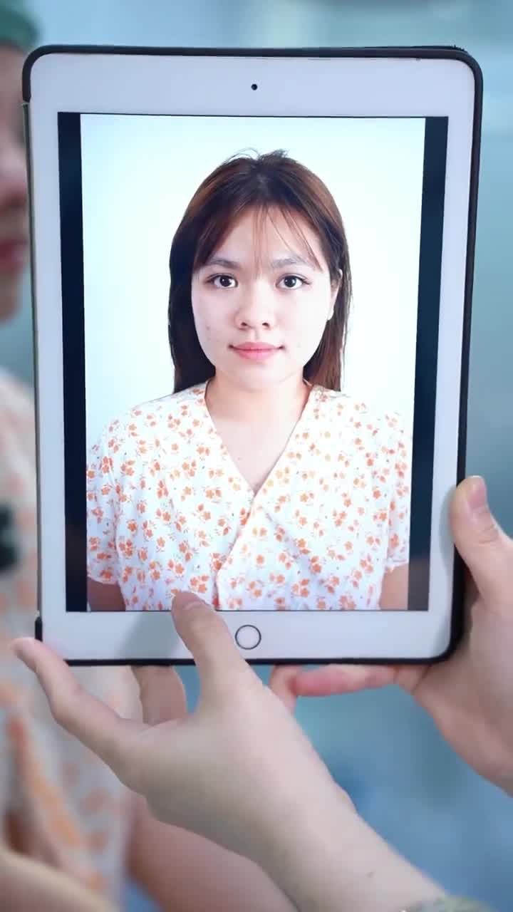 TRẢ KẾT QUẢ SAU 60 PHÚT THỰC HIỆN NÂNG MŨI CẤU TRÚC DR. HOẠT KH. YẾN VY