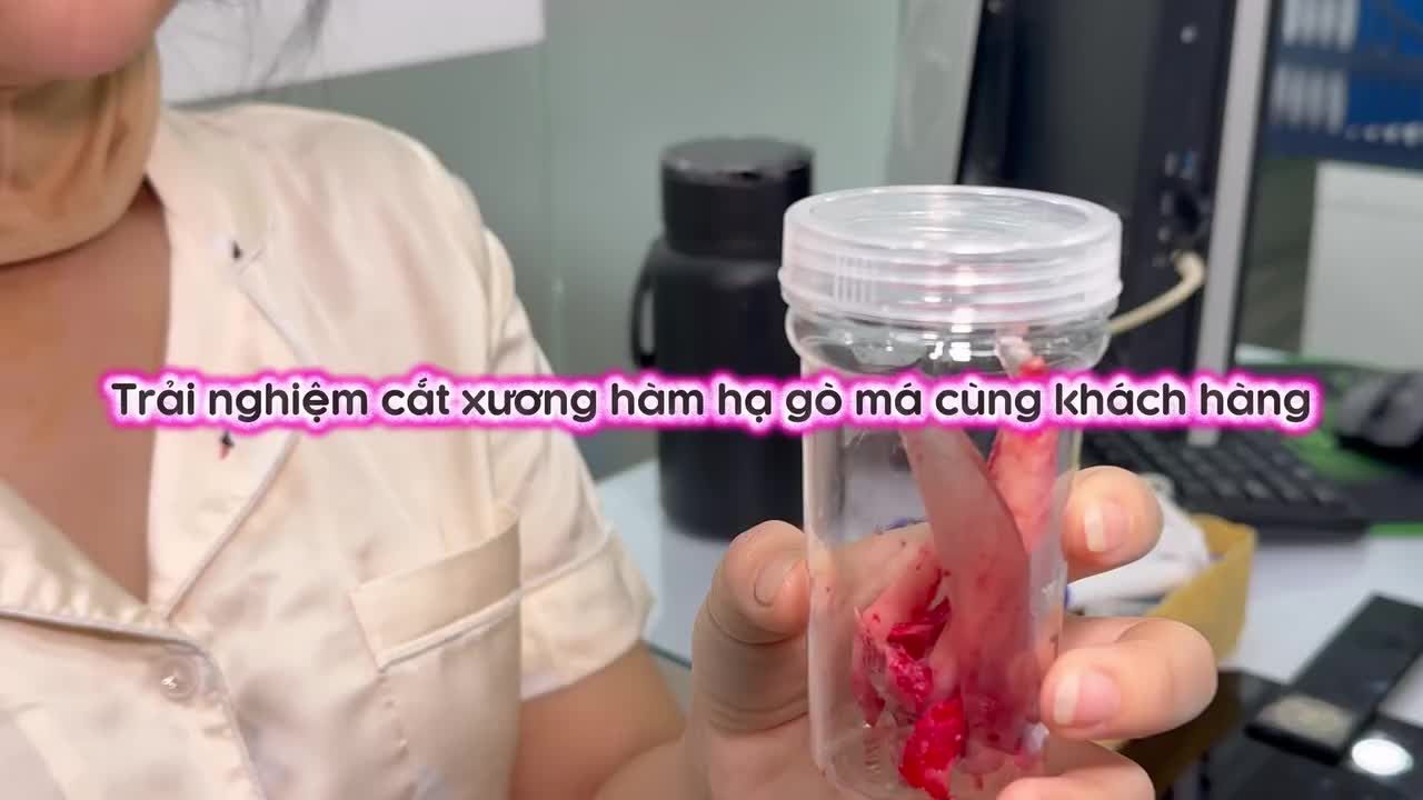 KHÁCH HÀNG REVIEW THỰC TẾ CẢM GIÁC SAU KHI GỌT HÀM HẠ GÒ MÁ
