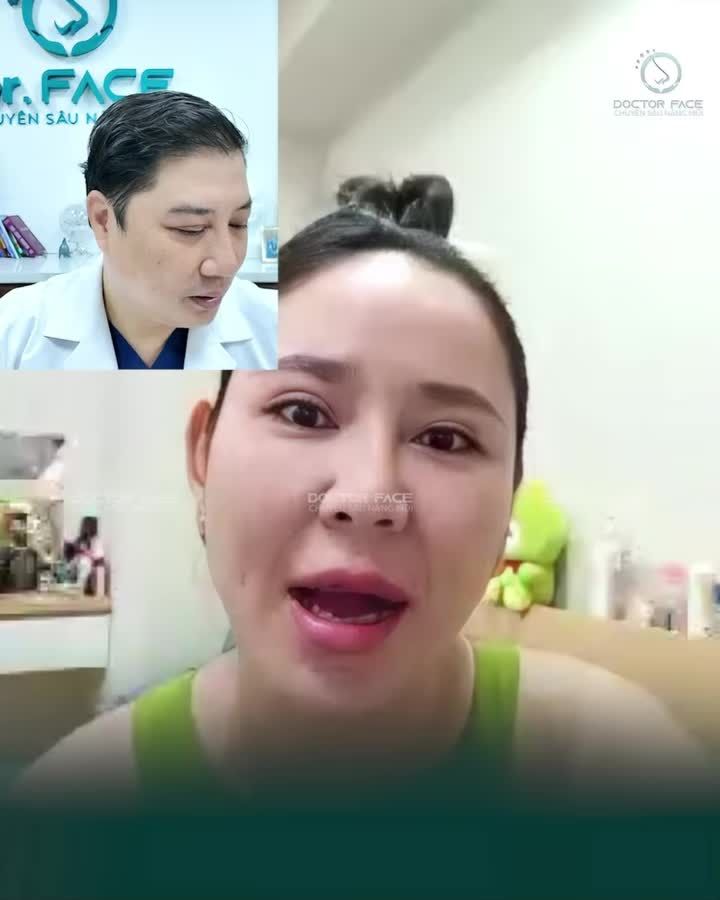 Đã từng nâng mũi rồi, nhưng trước khi sửa lại chị khách này vẫn hỏi về một điều mà rất nhiều người lo lắng Cùng nghe câu trả lời từ bs nha.