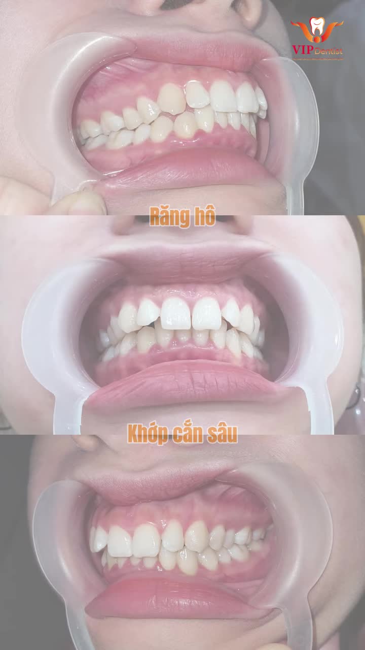 MỌI HÀNH TRÌNH NỖ LỰC ĐỀU NHẬN LẠI KẾT QUẢ XỬNG ĐÁNG!