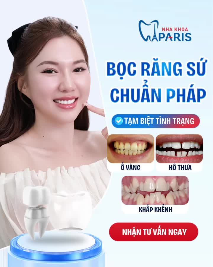 TẠM BIỆT RĂNG Ố VÀNG, KHẤP KHỂNH, HÔ THƯA VỚI DÁN SỨ VENEER CHUẨN PHÁP