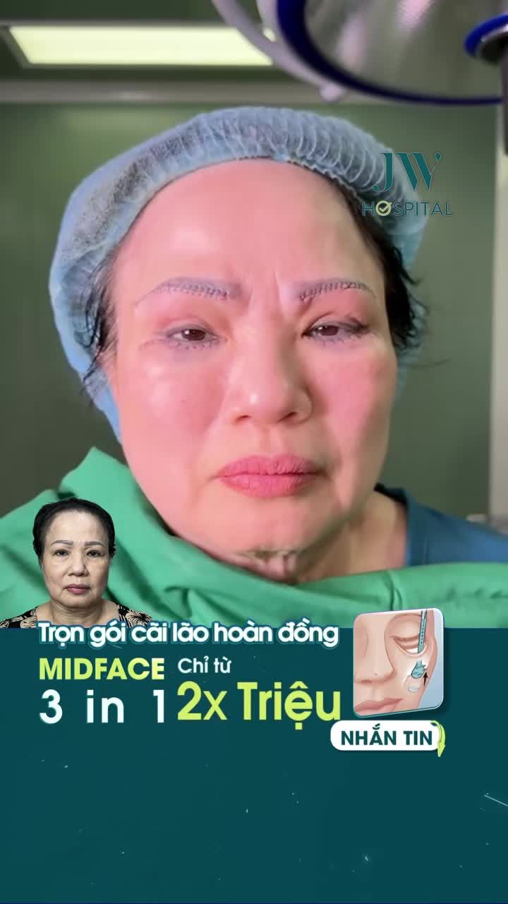 DA CHẢY XỆ, MẮT SỤP, GƯƠNG MẶT GIÀ HƠN TUỔI THẬT? VIỆT KIỀU MỸ U70 BẤT NGỜ TRẺ LẠI 20 TUỔI NHỜ ĐIỀU NÀY