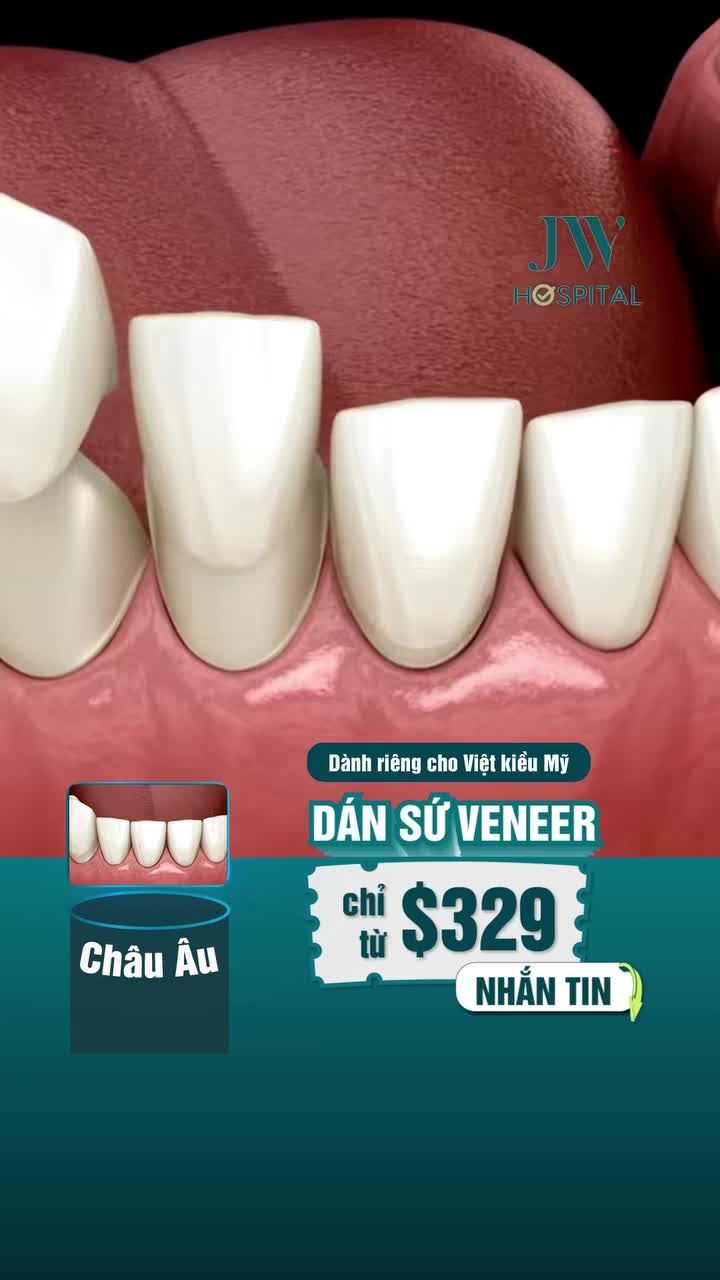 VIỆT KIỀU ĐỪNG DÁN SỨ VENEER Ở MỸ NẾU CHƯA BIẾT CHI PHÍ TẠI JW TIẾT KIỆM GẤP 7 LẦN!