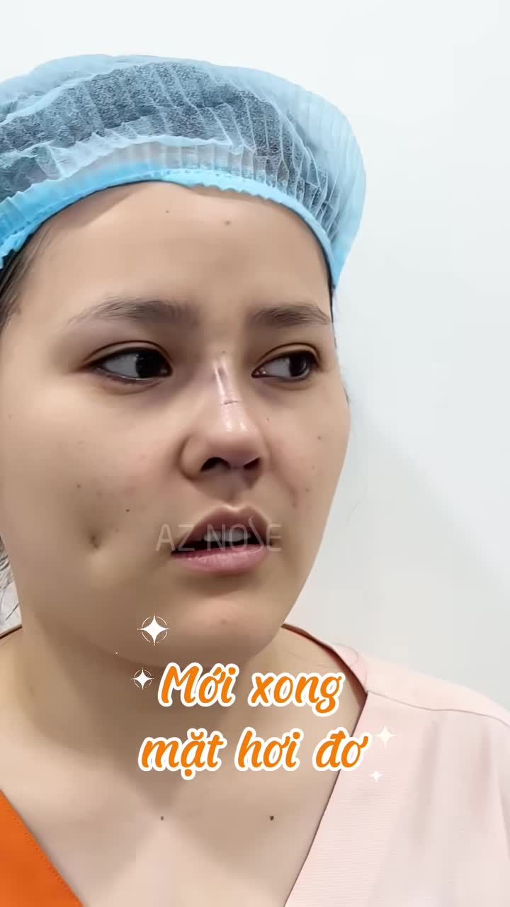 Nâng mũi hóa ra là tiểu phẫu khá nhẹ nhàng - nếu ngay từ đầu bạn lựa chọn đúng: