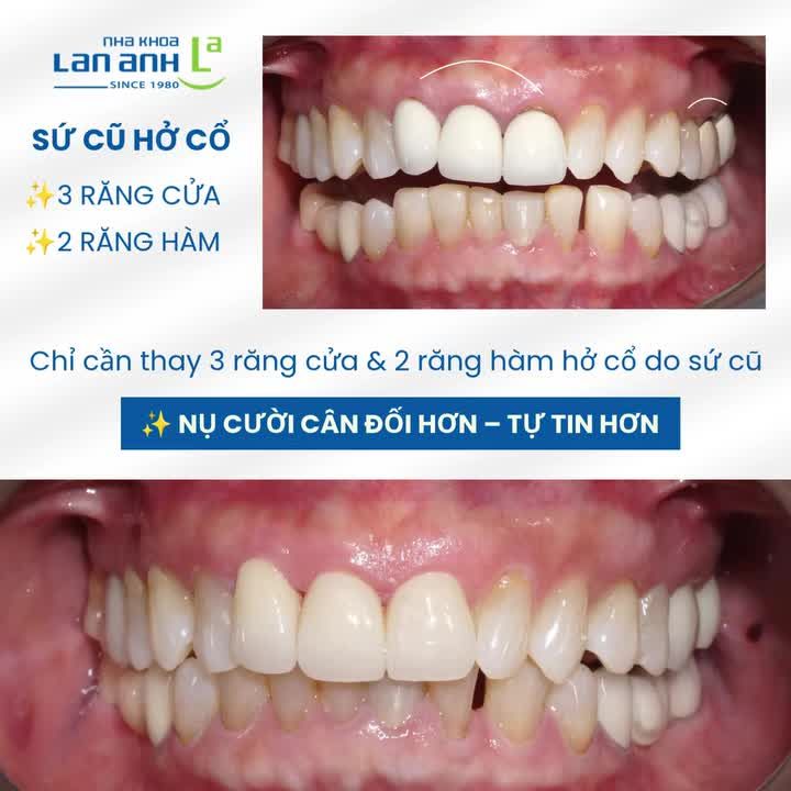 Một nụ cười đẹp không cần quá nhiều thay đổi.