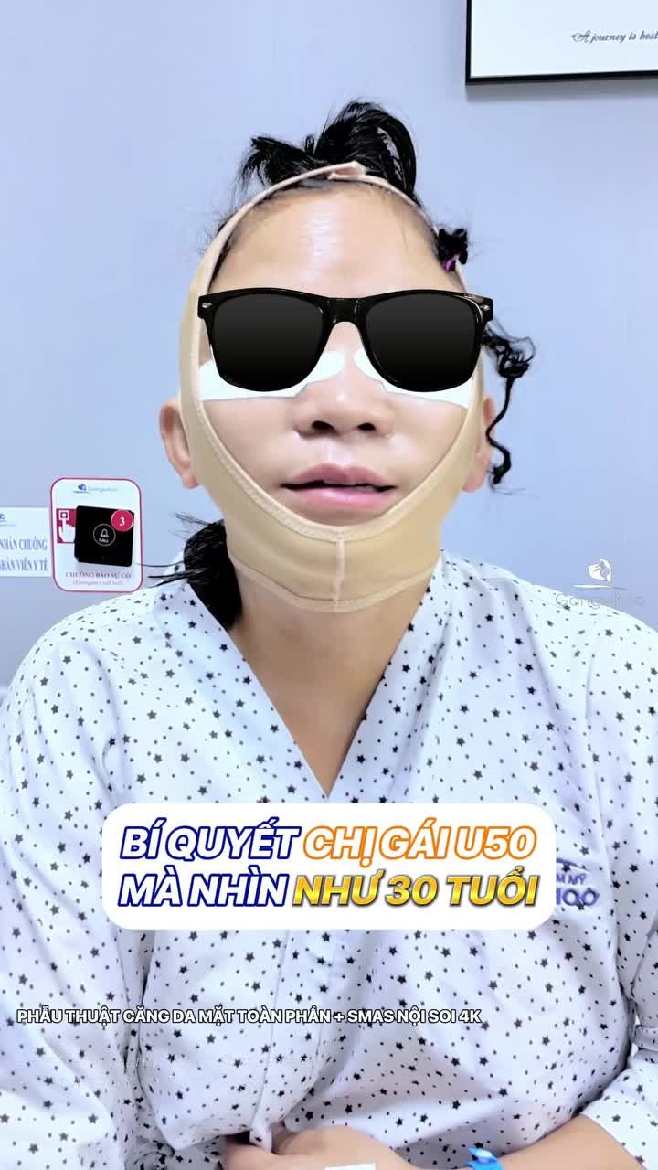 Bí quyết của chị U50 biến thành 30 tuổi chỉ sau 1 lần thực hiện phẫu thuật căng da mặt toàn phần + Smas nội soi 4K