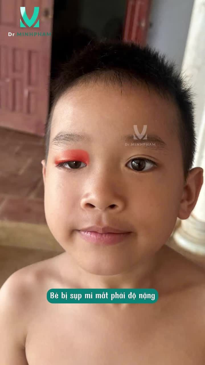 Từ ánh mắt còn nhiều hạn chế đôi mắt mở rõ hơn, linh hoạt và tự tin hơn mỗi ngày